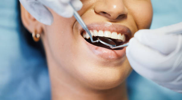 Best Emergency Gum Treatment in Arkwright, SC