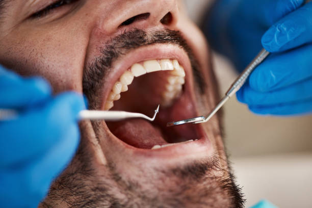 Best Urgent Care for Lost Fillings or Crowns in Arkwright, SC